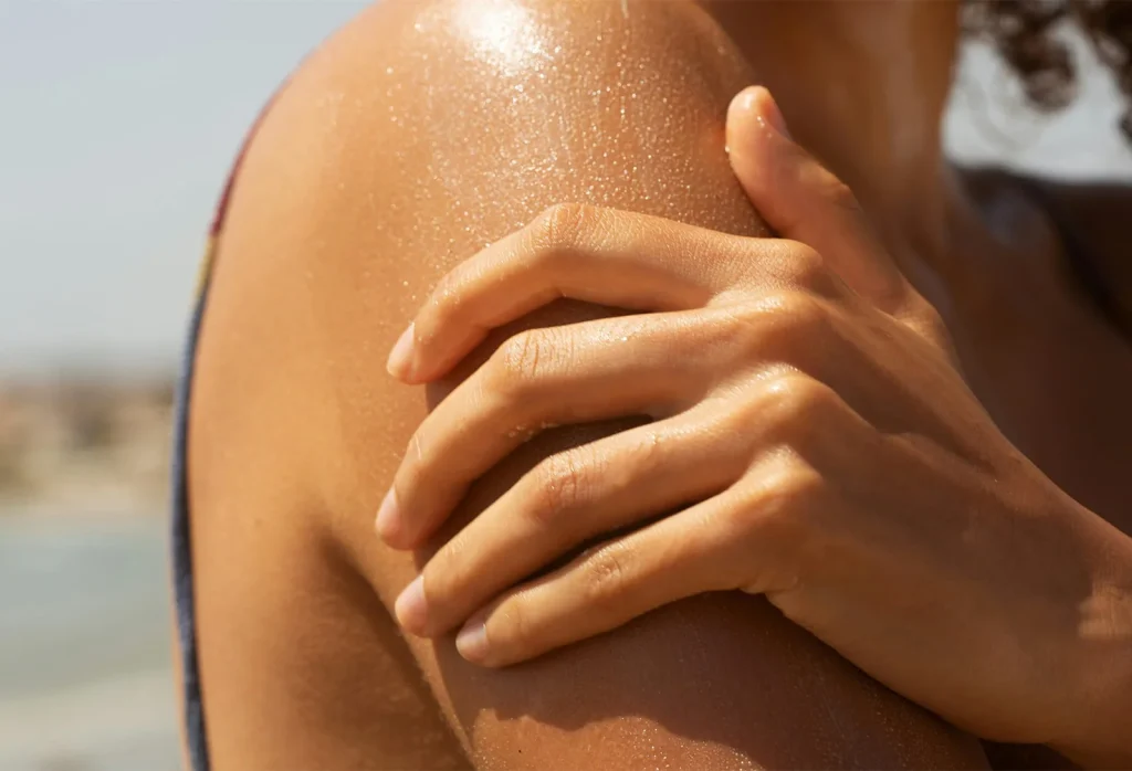 Post-Sun Care Is Set for a Global Boom